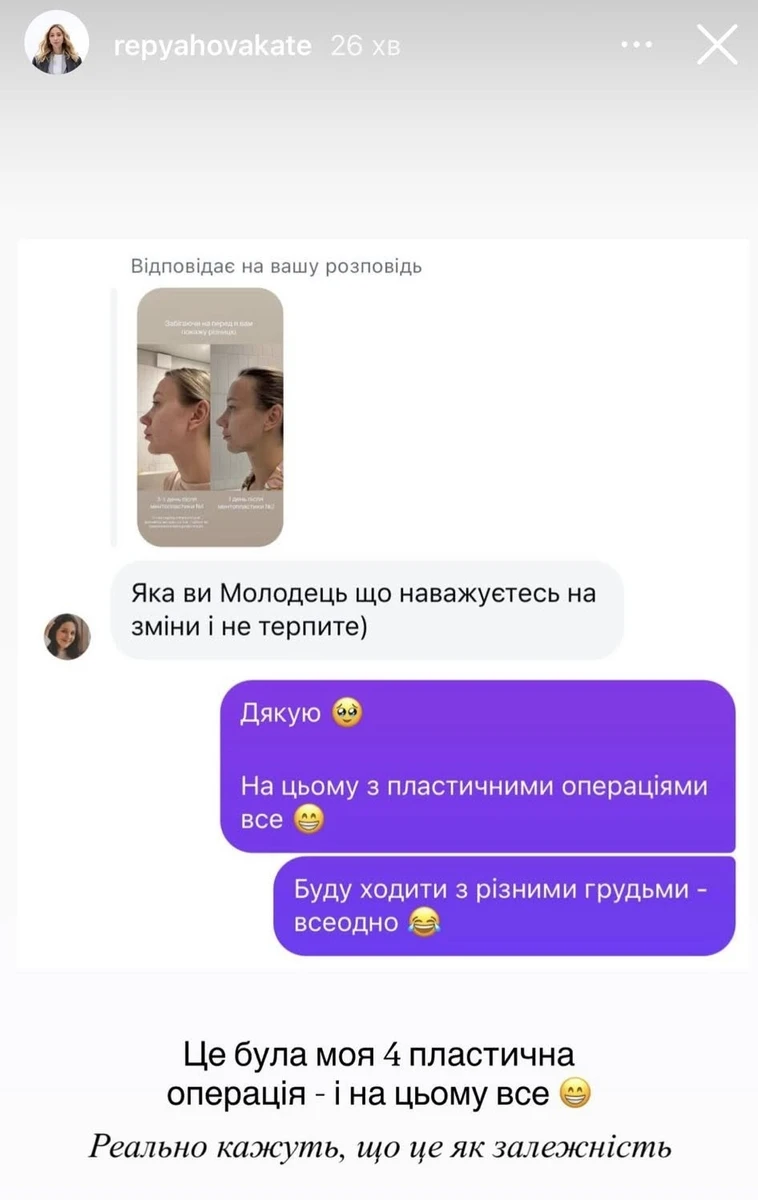 А от робити мамопластику Репяхова вже передумала. Хоча колись навіть приміряла імпланти