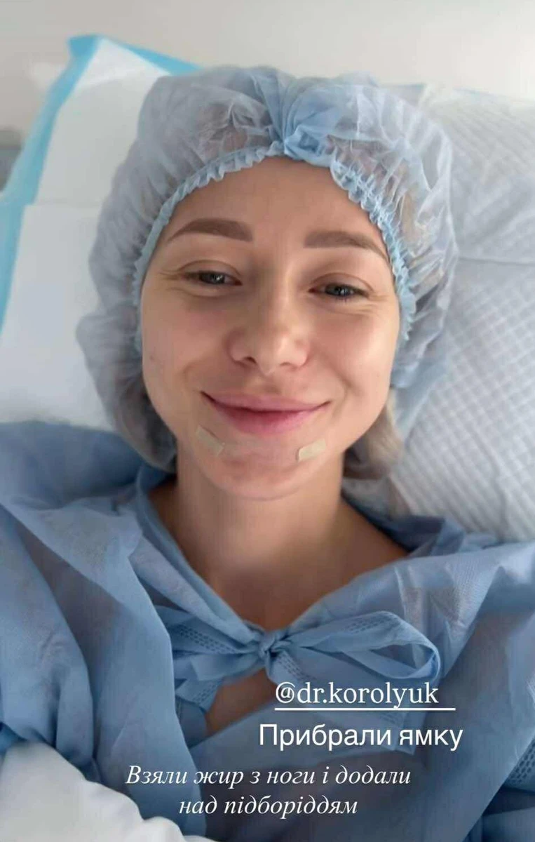 Репяхова зробила ліпофілінг підборіддя