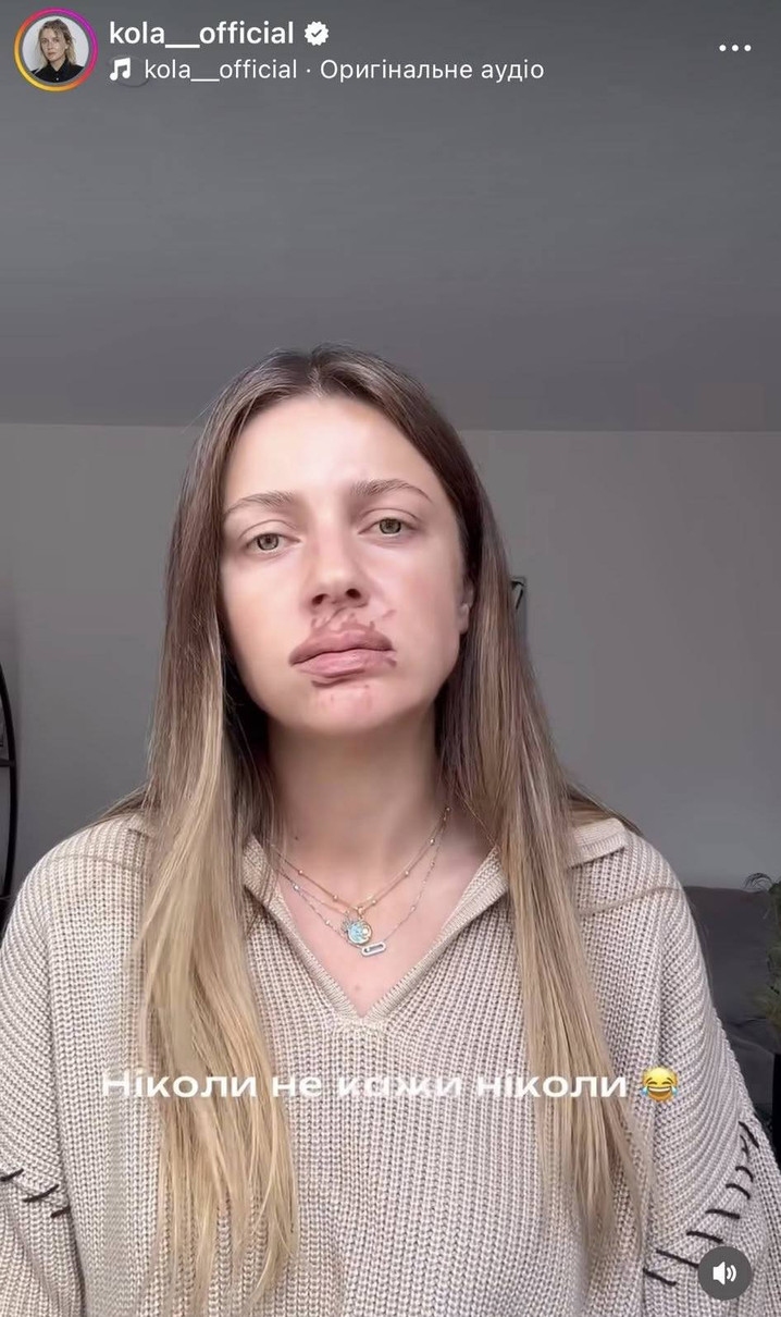 Співачка Кола