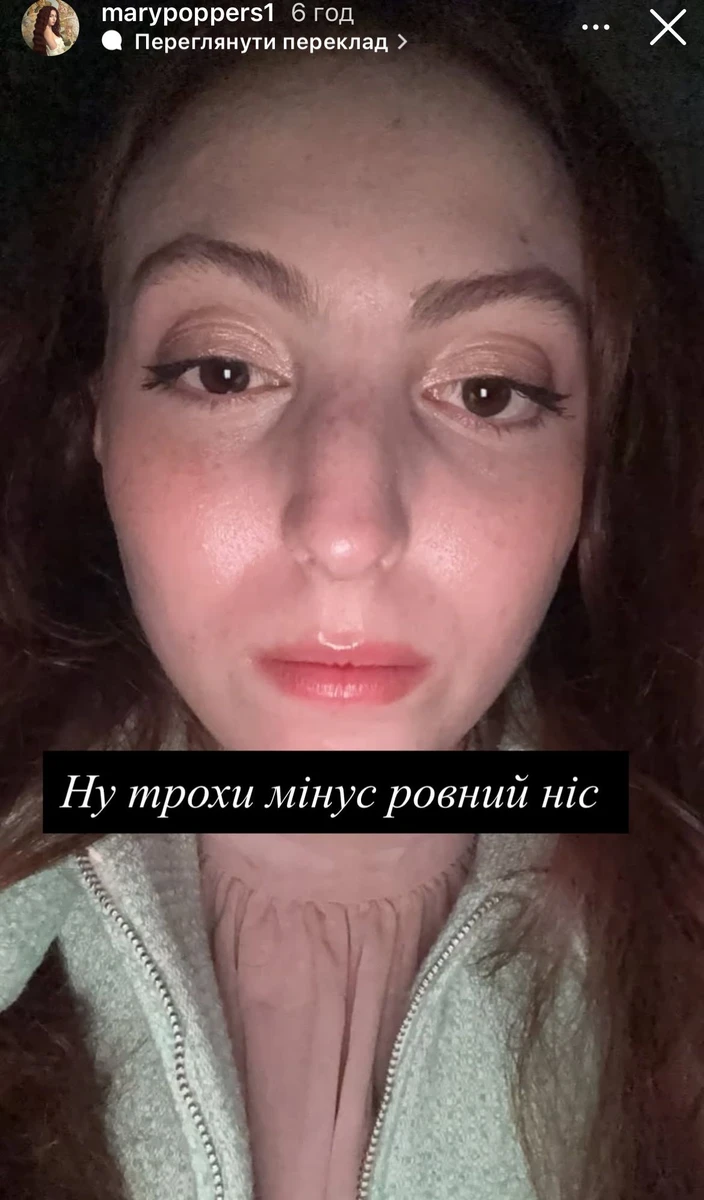 Маша Полякова зі зламаним носом