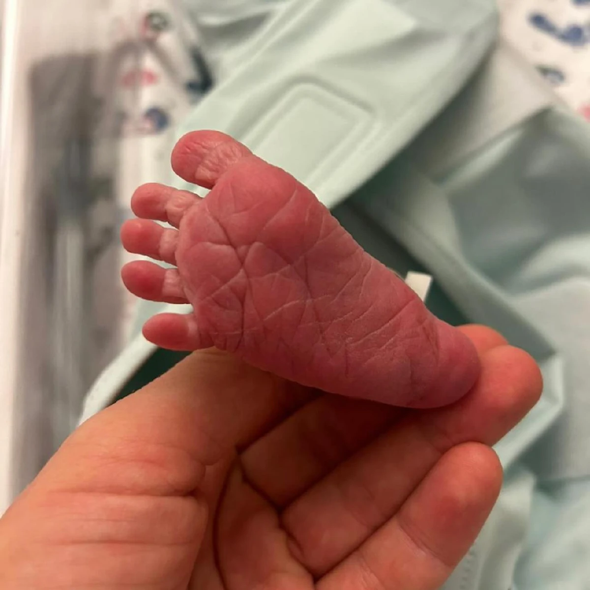 Фото зроблено в перший день життя Остапа