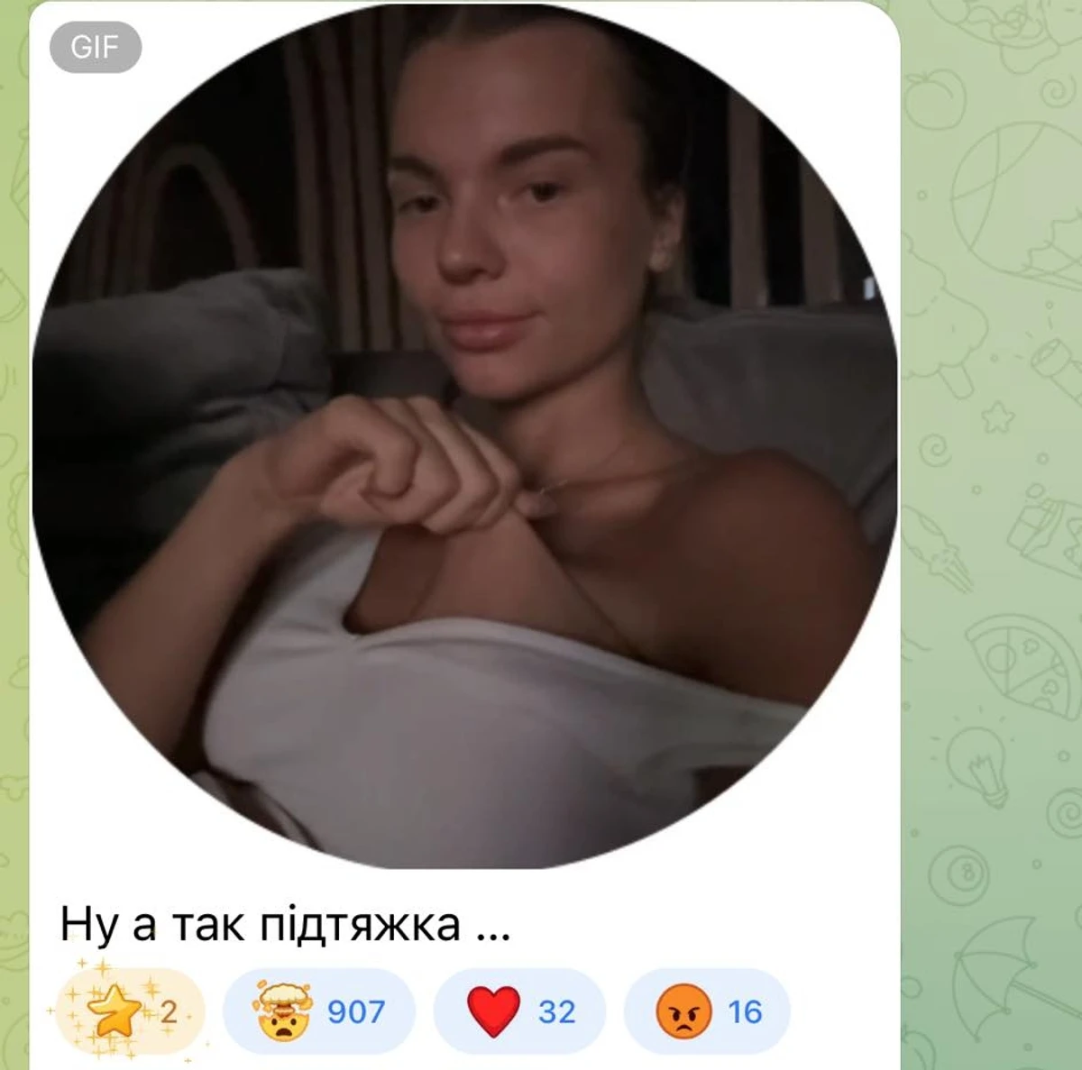 Блогерка Скальницька та результат мамопластики