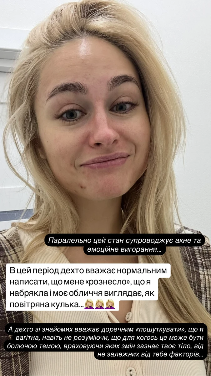 Анастасія Цимбалару розповіла про свій гормональний збій