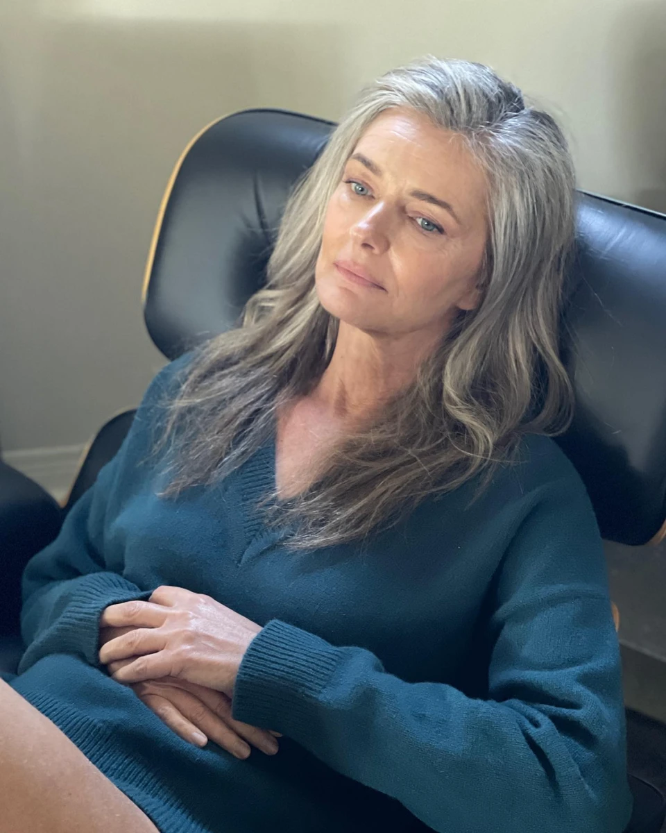 Модель поміркувала про шрами