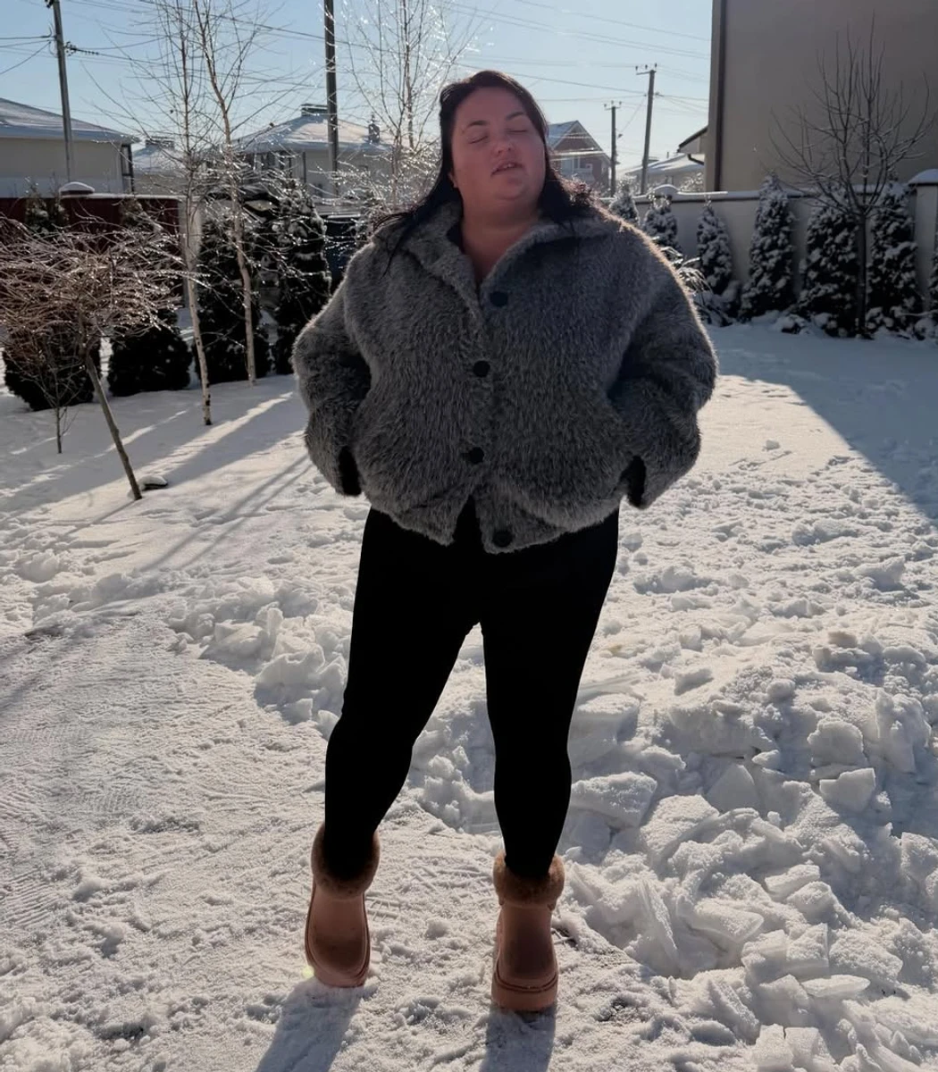 Комікеса Анастасія Ткаченко зізналася, що зменшила шлунок, бо їй не допомогли дієти