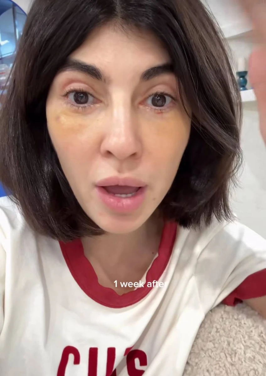 За словами Мусіної, через те, що вона стала жертвою роботи непрофесіоналів, операції було не уникнути