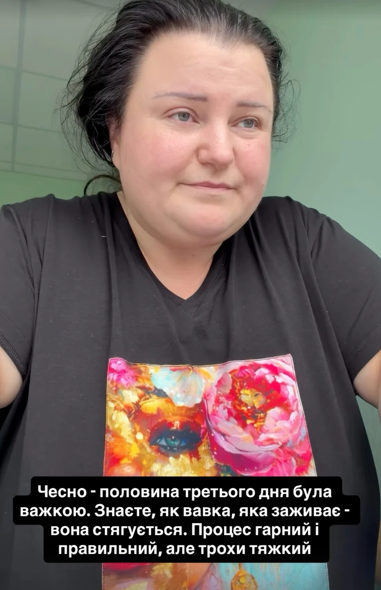 alyona alyona розповіла про свій стан після зменшення шлунку