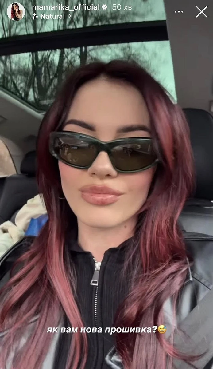 Збільшення губ