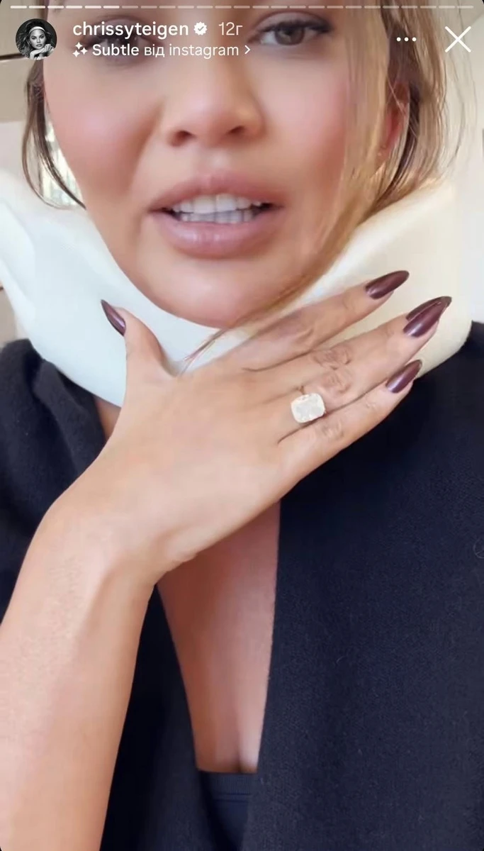 Модель не може крутити шиєю та змушена носити комір