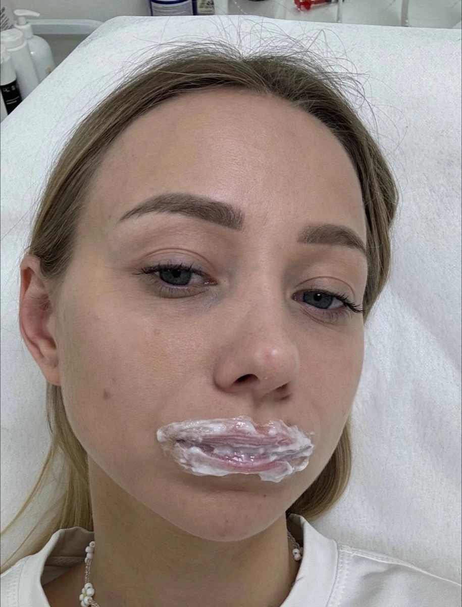 Дівчина - збільшує губи. Жінка - збільшує губи, щоб потім зменшити, щоб потім збільшити