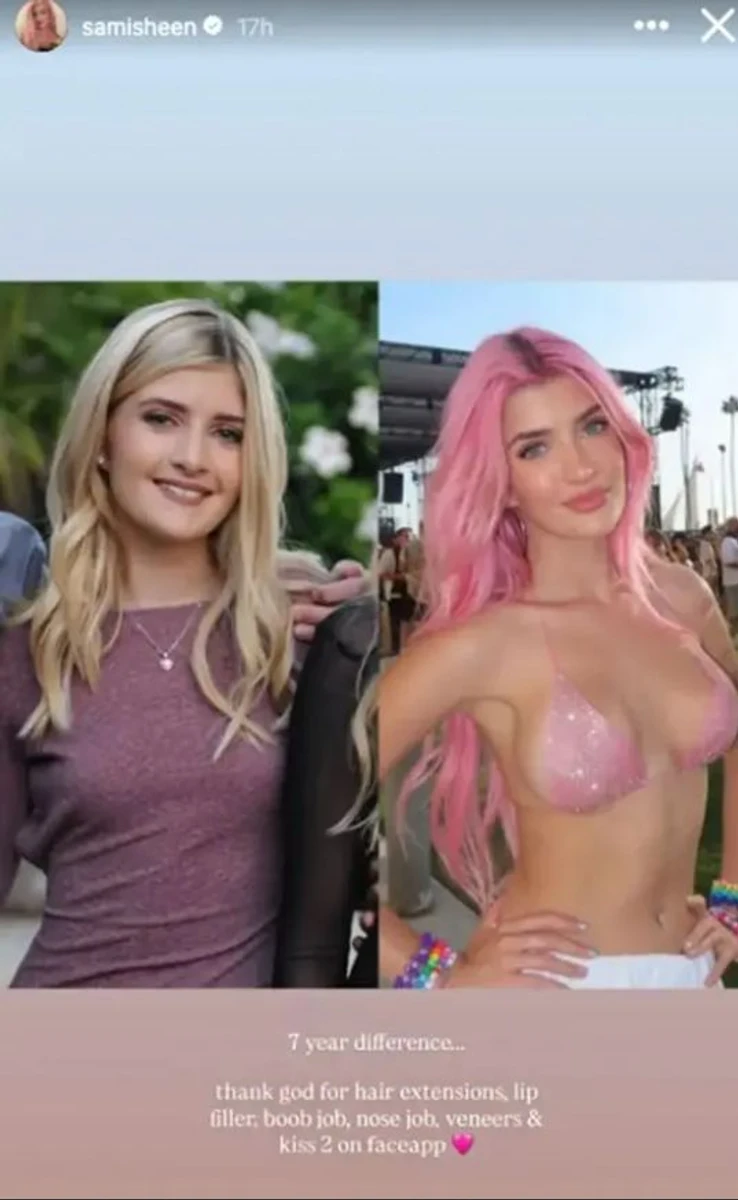 Дочка Чарлі Шина показалася до пластики