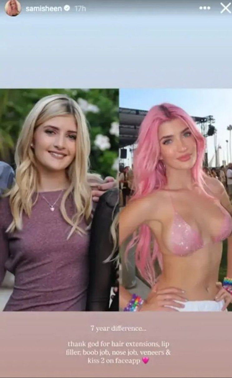 Дочка Чарлі Шина показалася до пластики