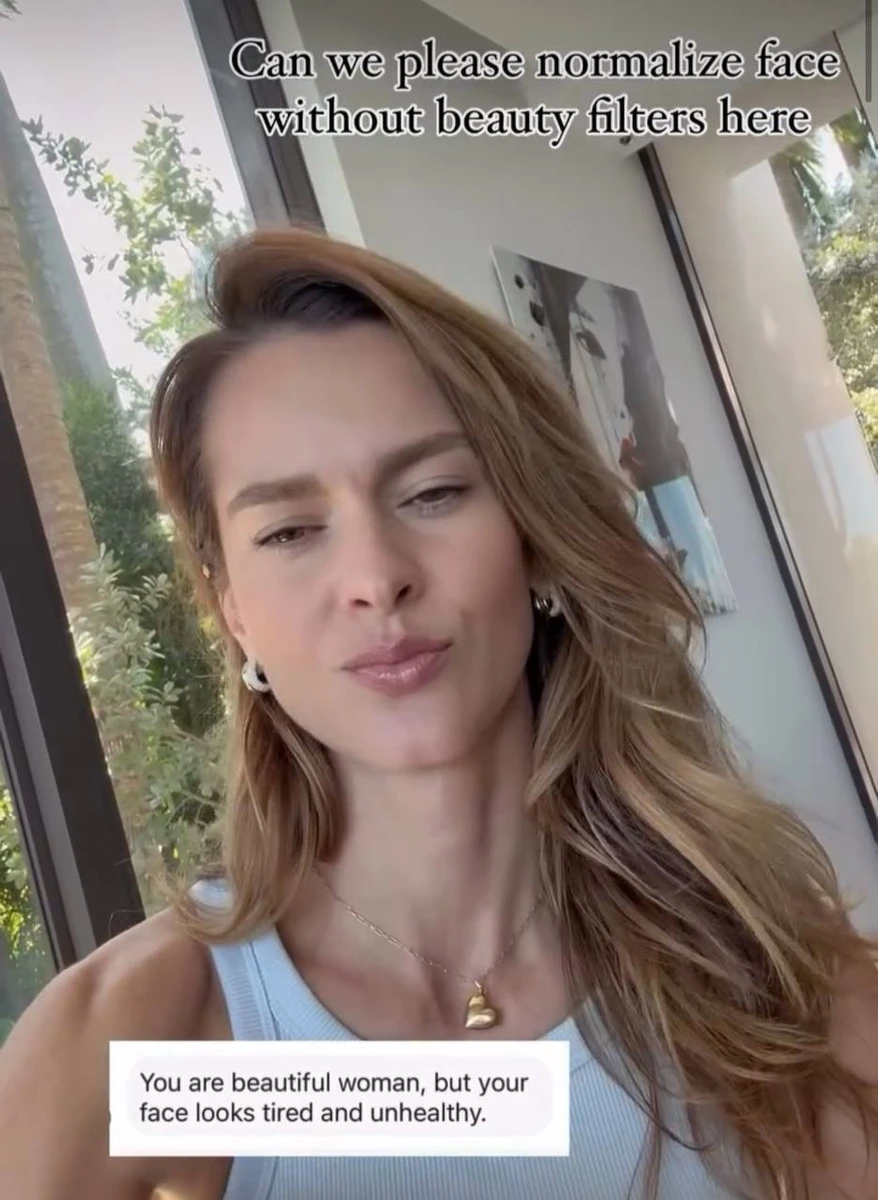 У відповідь Олеся закликала нормалізувати обличчя без використання б'юті фільтрів