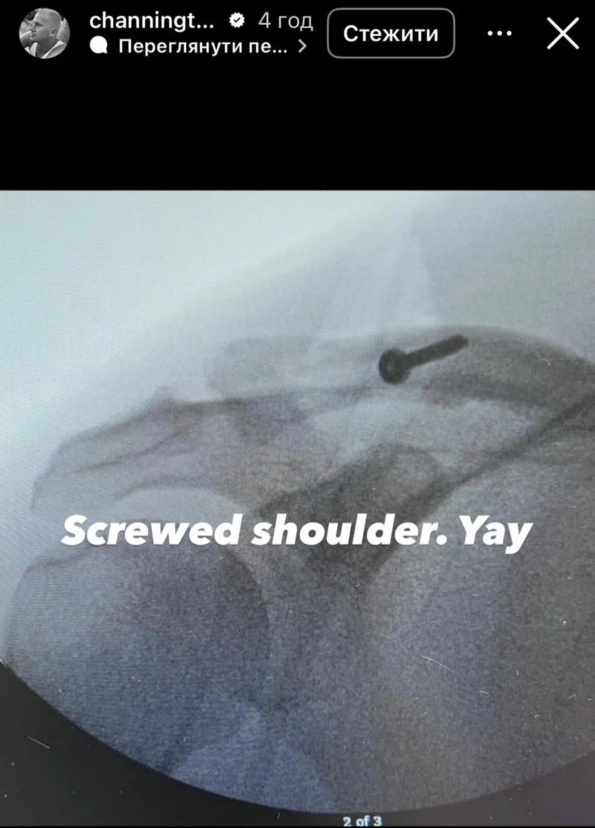 Плече скріпили гвинтом. Ура, - написав Татум