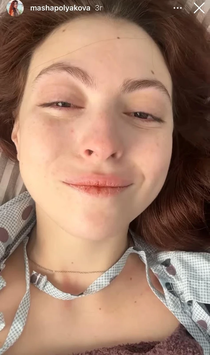 Ну що, мені вже зробили операцію, - повідомила Полякова-молодша 