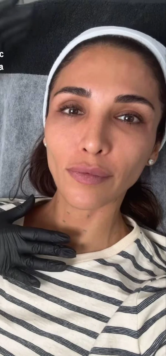 Дімопулос у косметолога