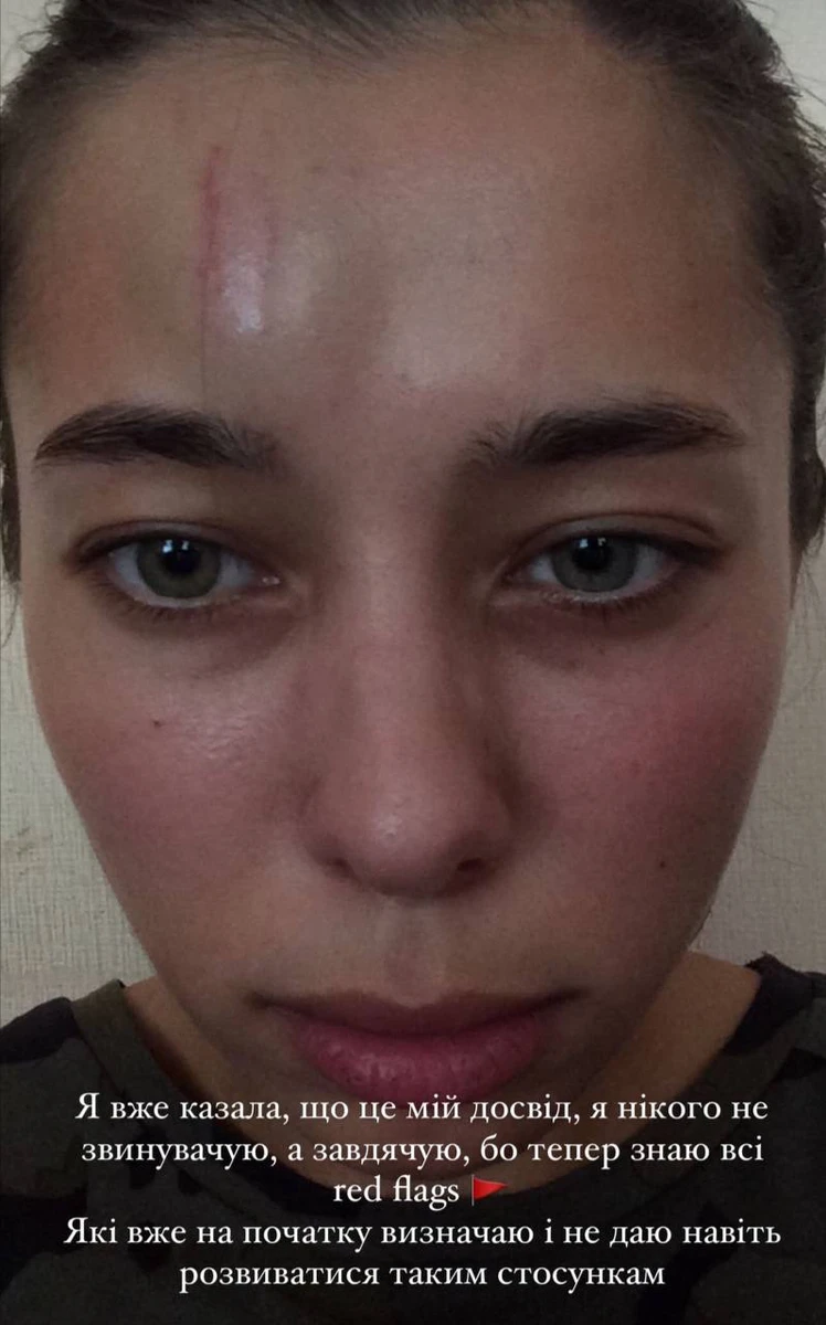 В свої 29 Анна знає, як присікти аб'юз і уникнути його