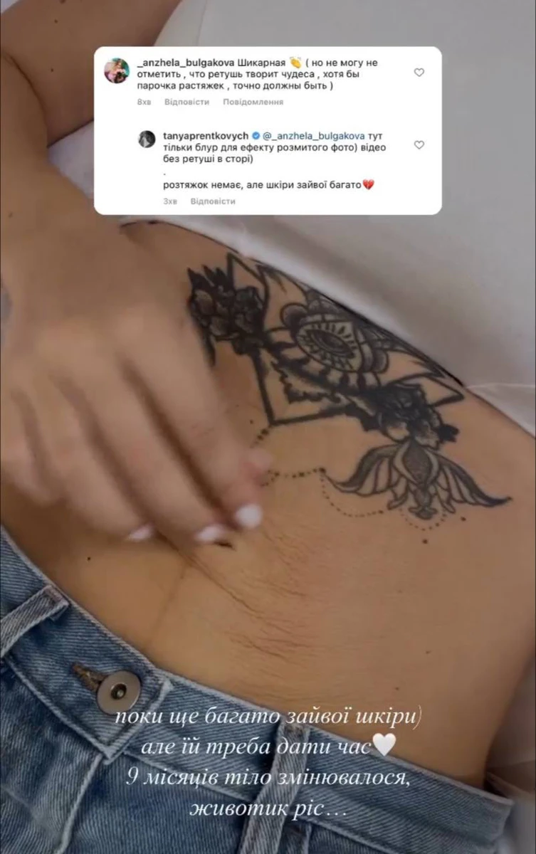 Пренткович не фотошопить і з задоволенням показує свої розтяжки і зайву шкіру 