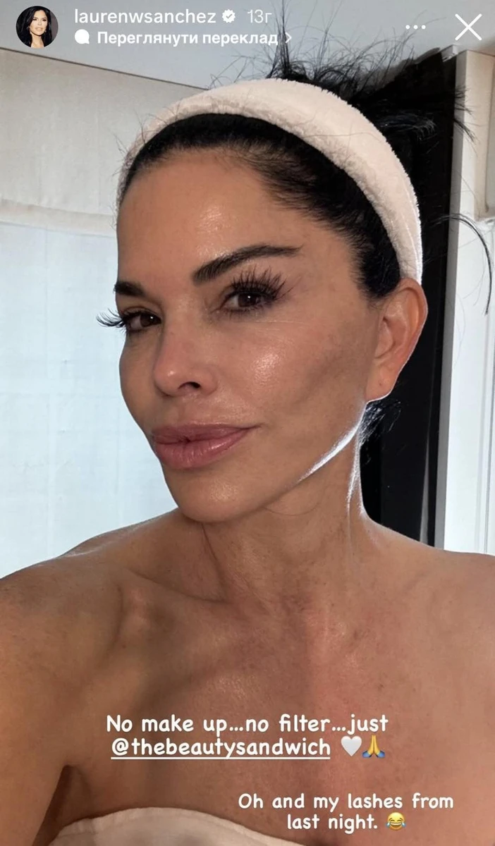 Санчес похвалилася гарним станом шкіри, яким завдячує б'юті-процедурам