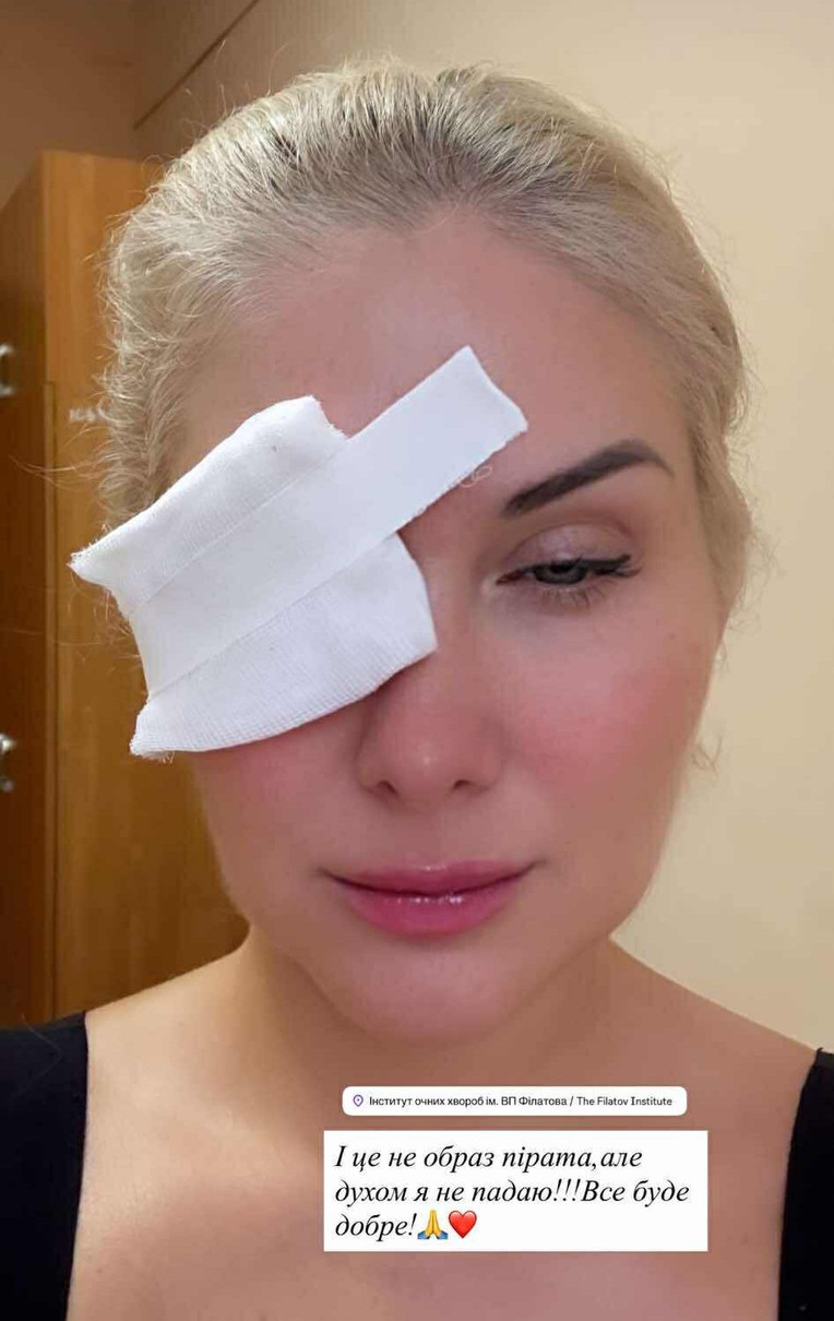 Бужинська з пошкодженим оком