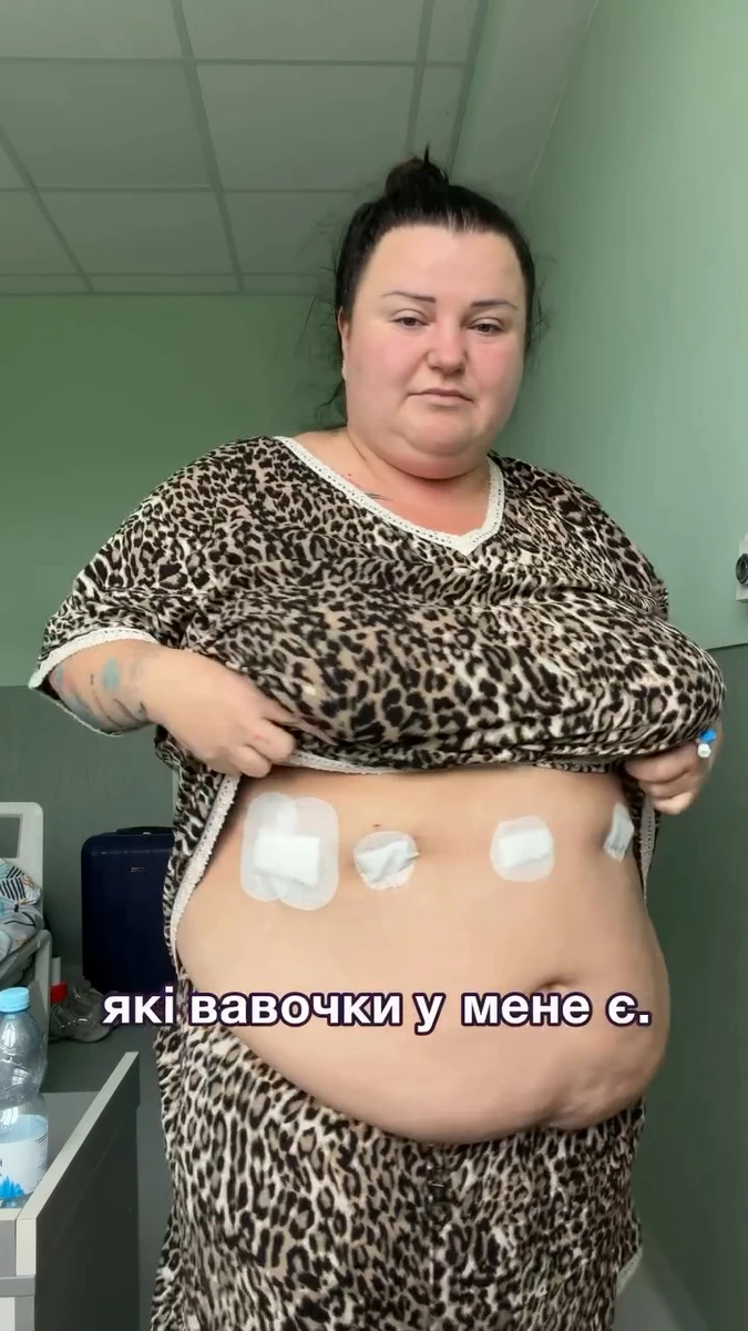alyona alyona показалася після операції зі зменшення шлунку