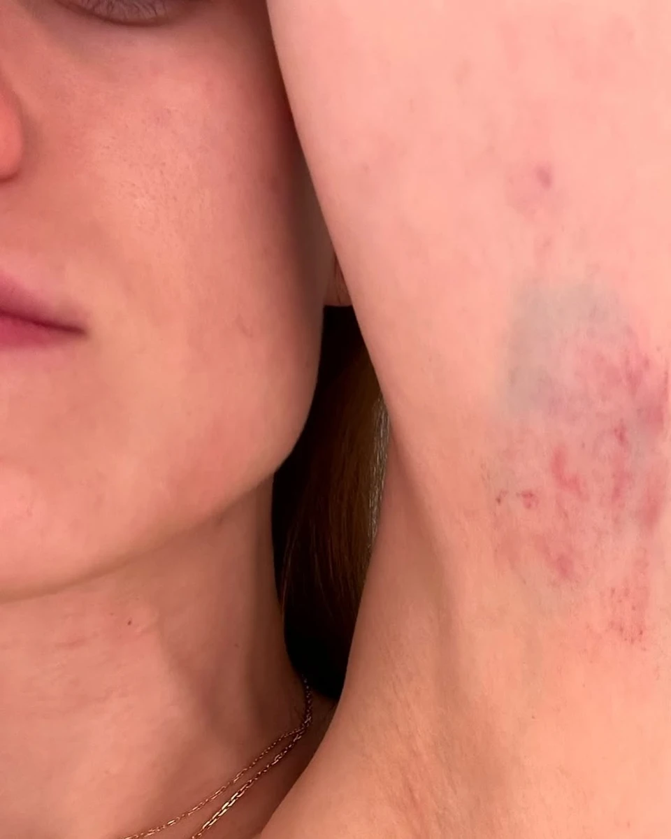 Сліди домашнього насильства