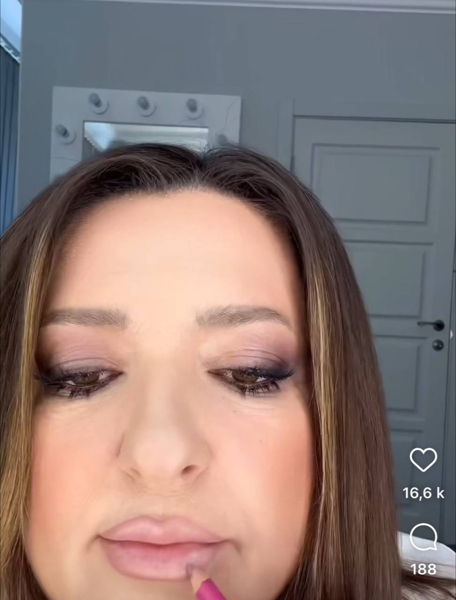 Наталія також занижає центральну частину нижньої губи