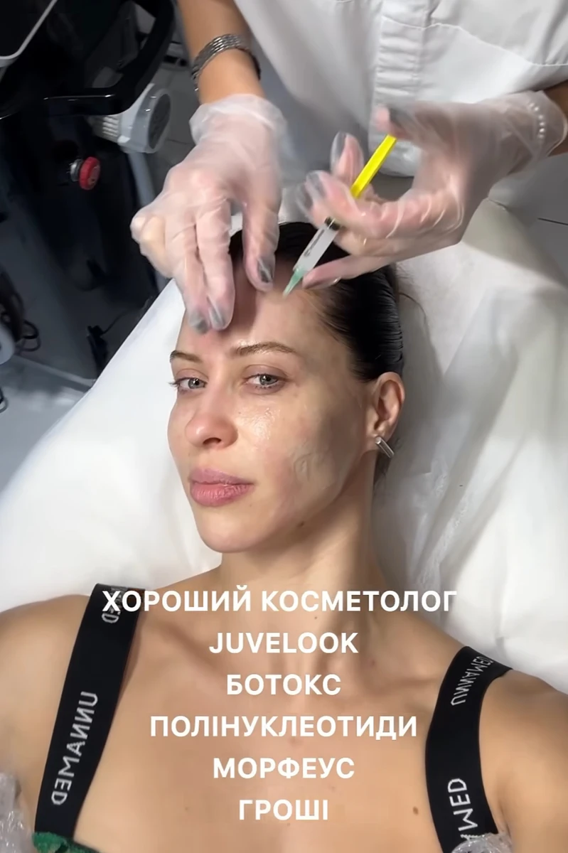 Вікторія Маремуха показала, як їй роблять укол в чоло