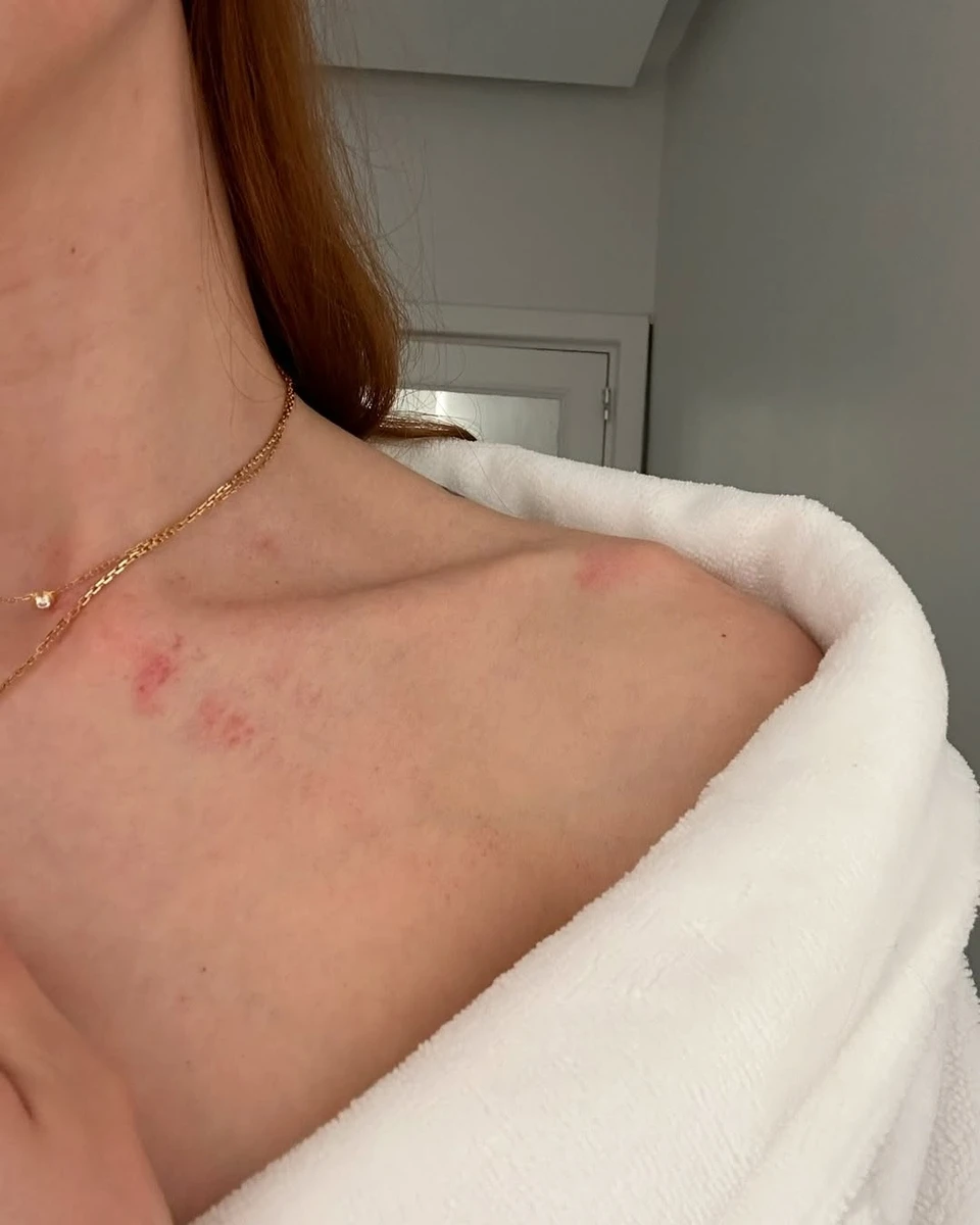 Анастасія Суббота про домашнє насильство