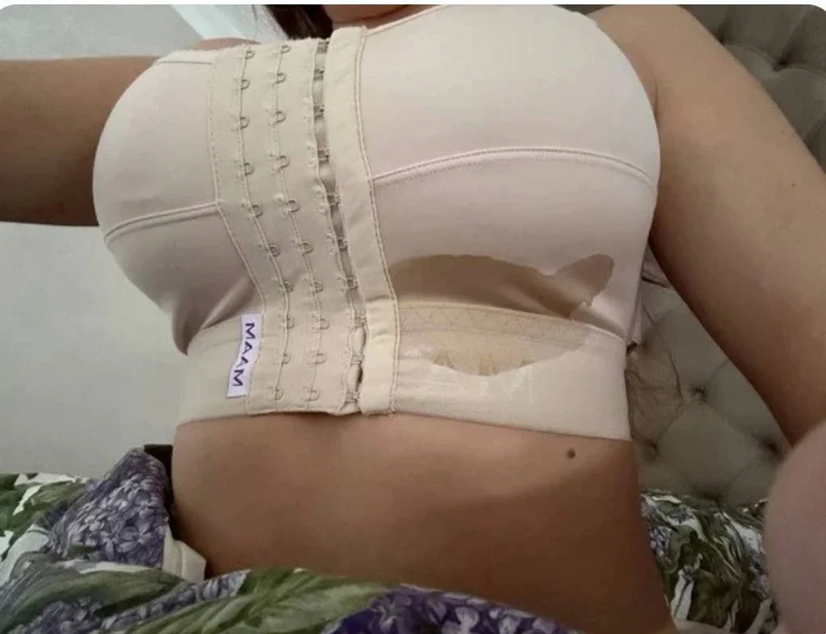 Юлія Верба показала, як з грудей витікає рідина після операції