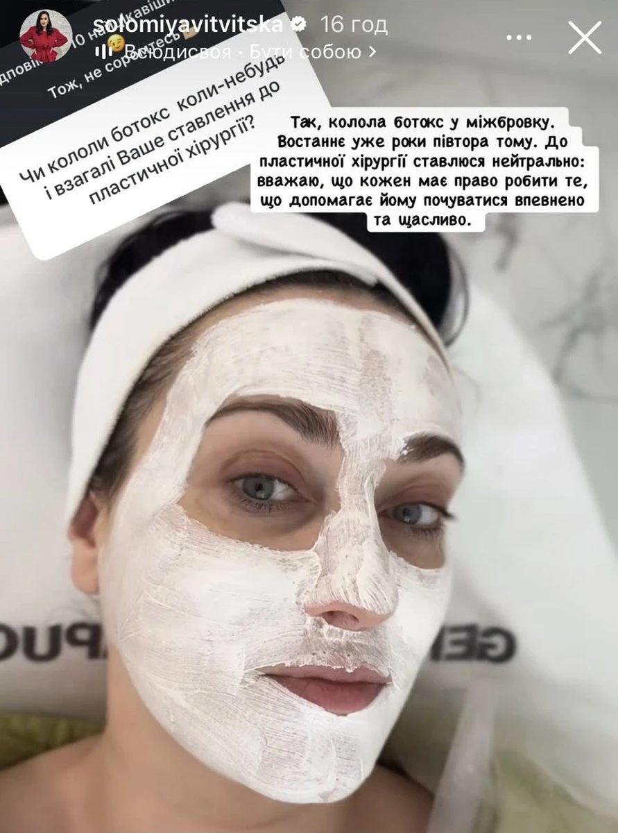 Соломія Вітвіцька про ботокс