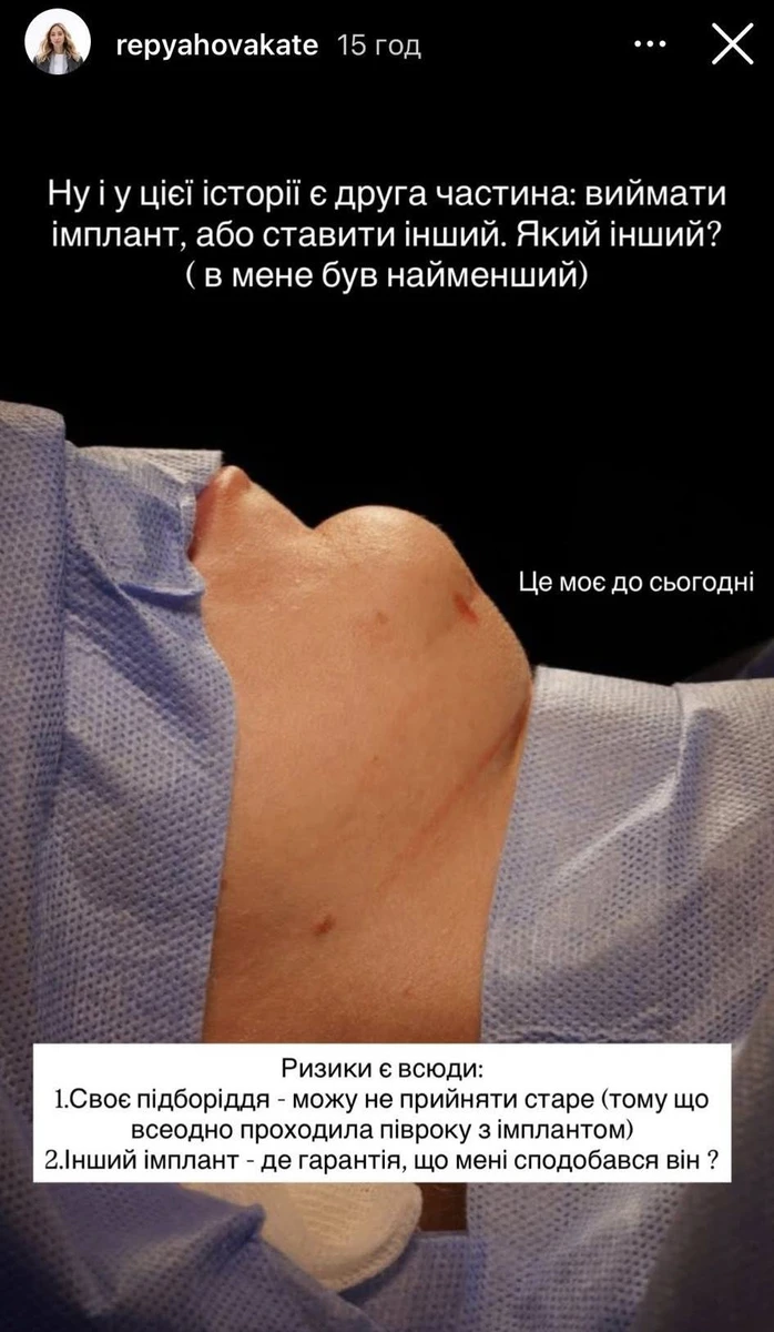 Дружина артиста зважилася на нову операцію