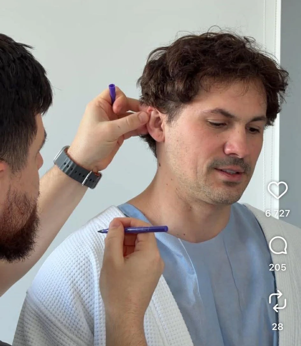 На відео лікар щось позначає на вухах так, як зазвичай роблять пластичні хірурги 