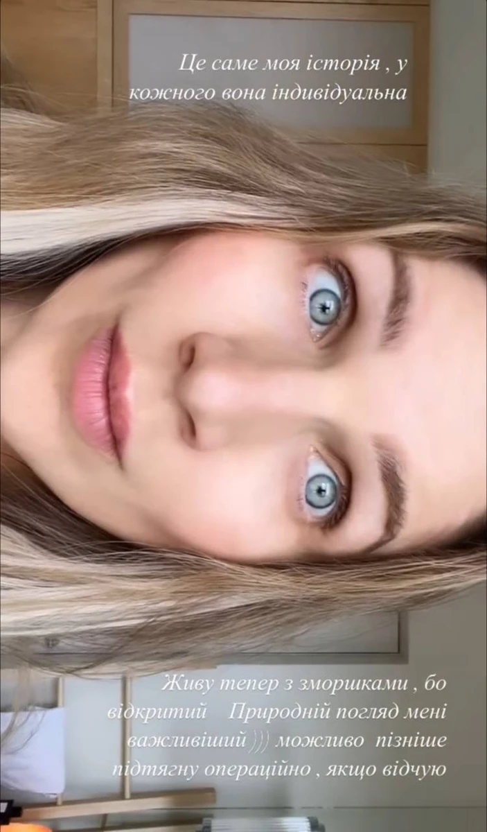 Задля збереження погляду Катя готова ходити зі зморшками. Воно дійсно того варте, коли мова йде при індивідуальність