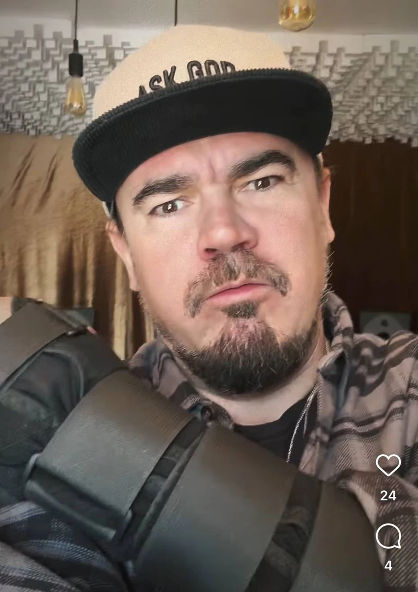 Фагот показав зламану руку