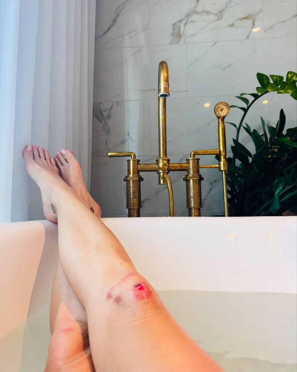 Кеті Перрі показала коліна у подряпинах