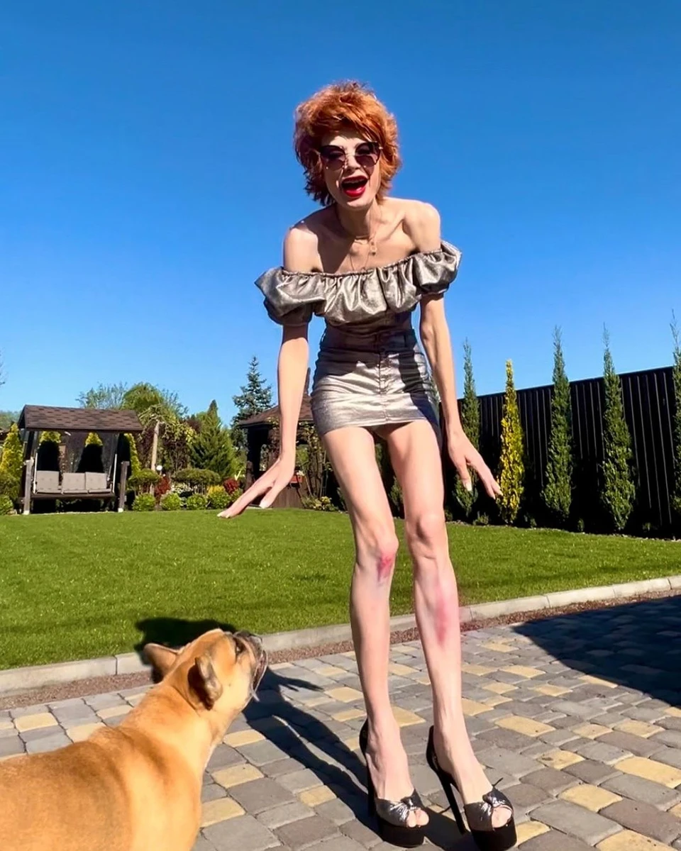 На синці Олени боляче дивитися, але вона, схоже, не засмучується 