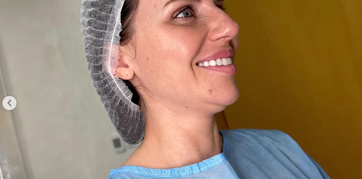 Аня зізналася, що саме друге підборіддя було її найбільшим комплексом все життя 