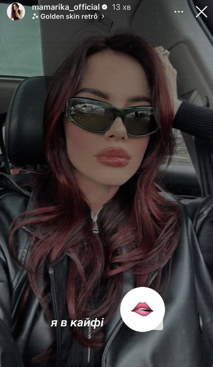 Губи після уколів