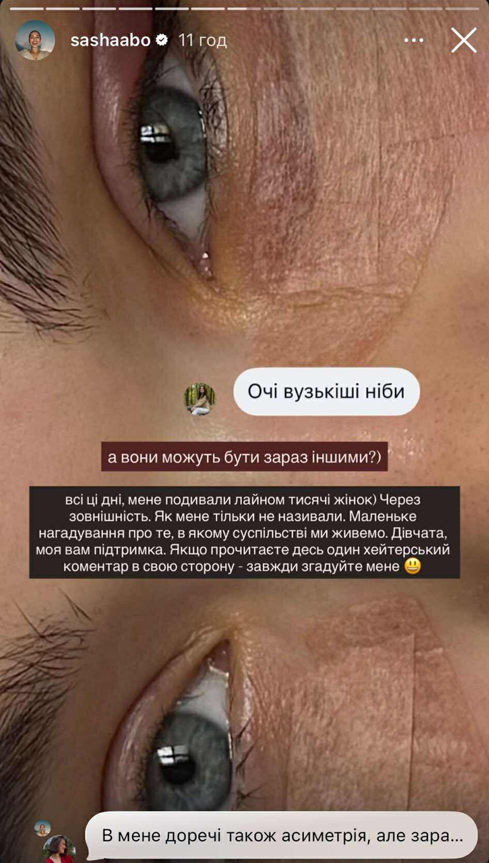 Саша Бо зробила підтяжку обличчя і зіткнулася з хейтом