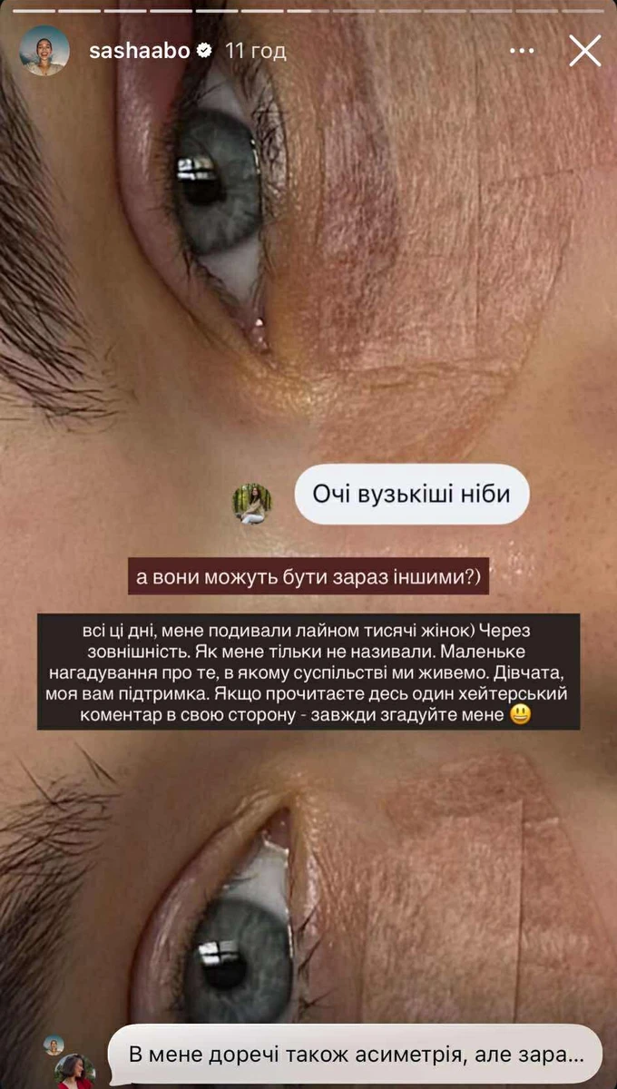 Саша Бо зробила підтяжку обличчя і зіткнулася з хейтом