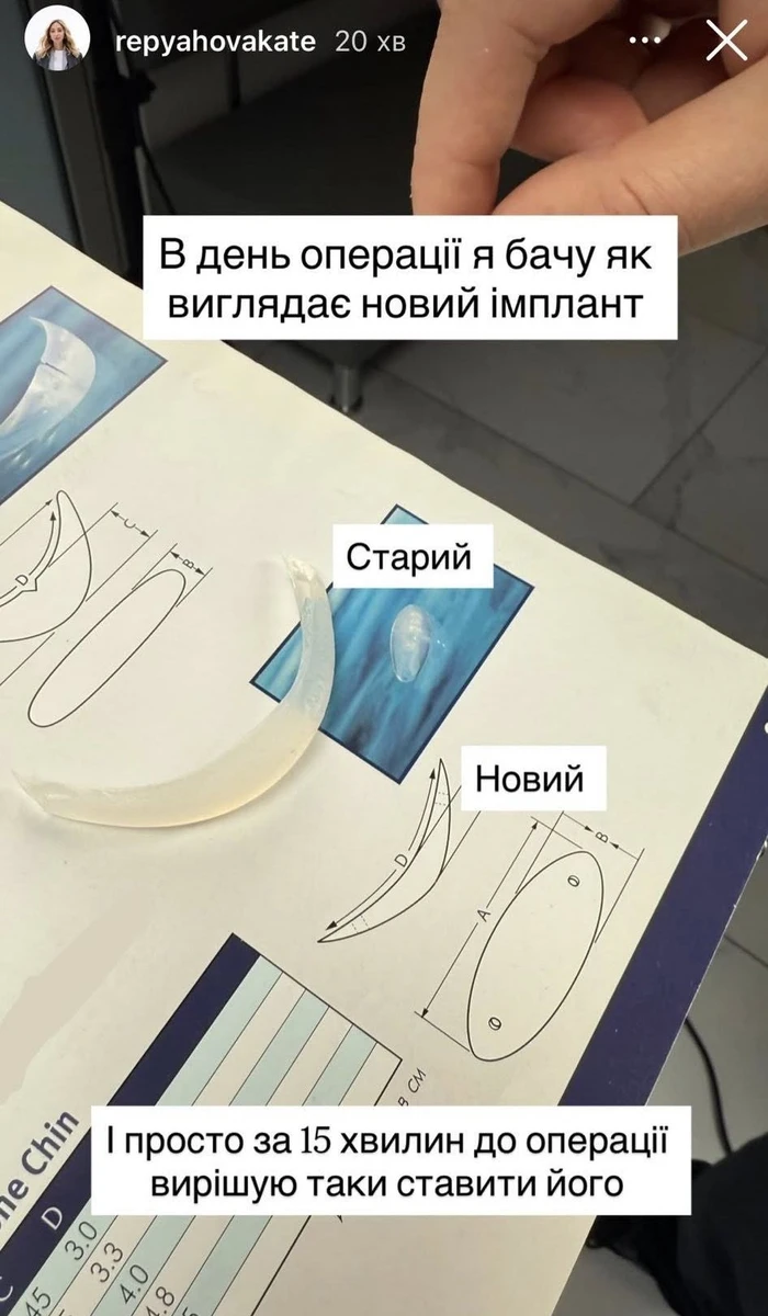 Дружина Павліка та імплант в підборіддя