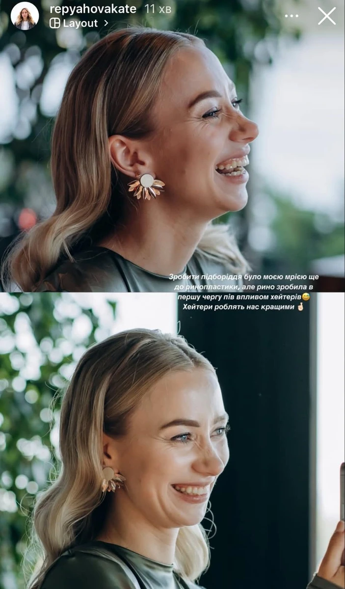 Репяхова до пластичних операцій