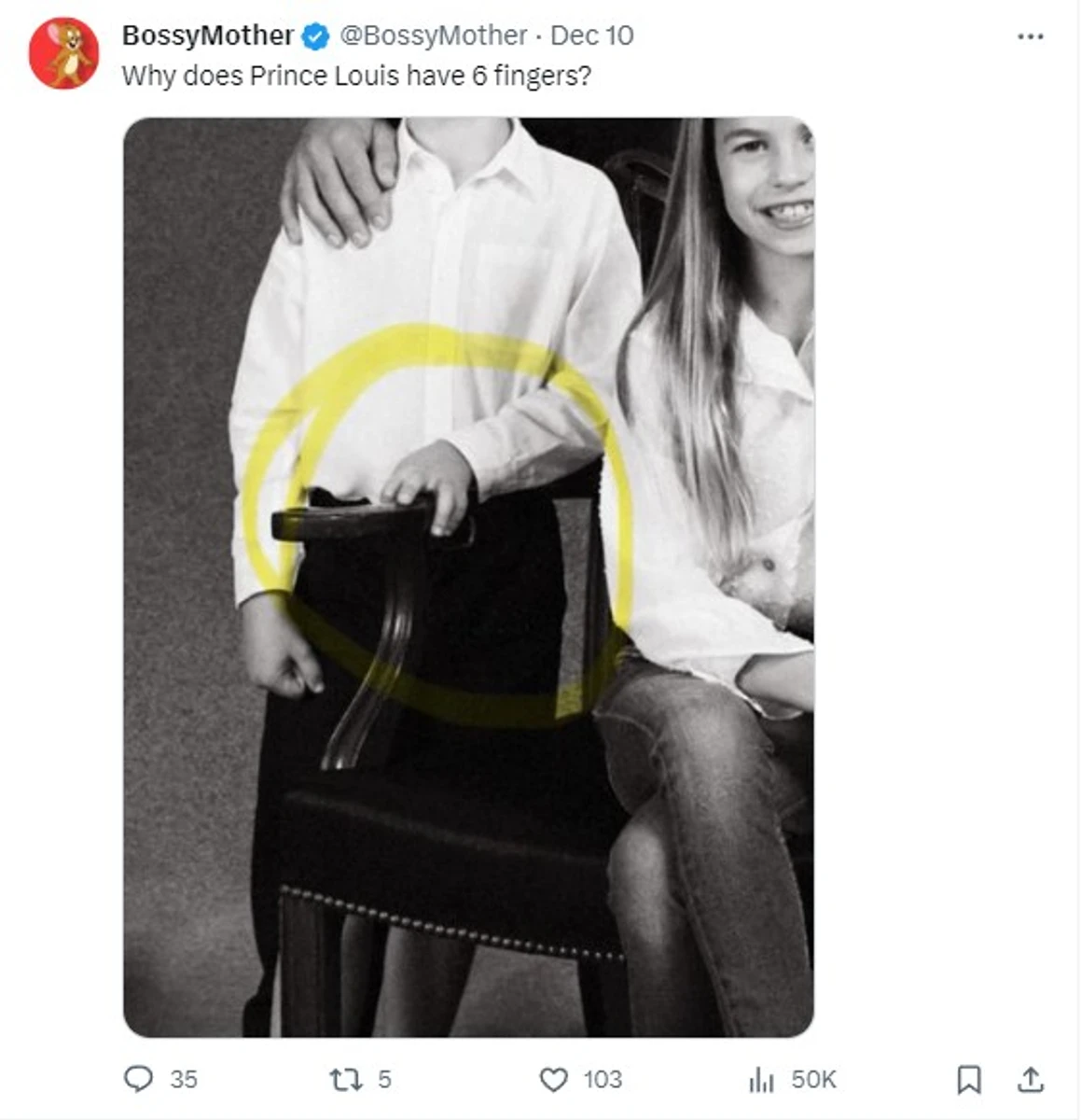 А комусь на цьому фото, навпаки, пальців забагато