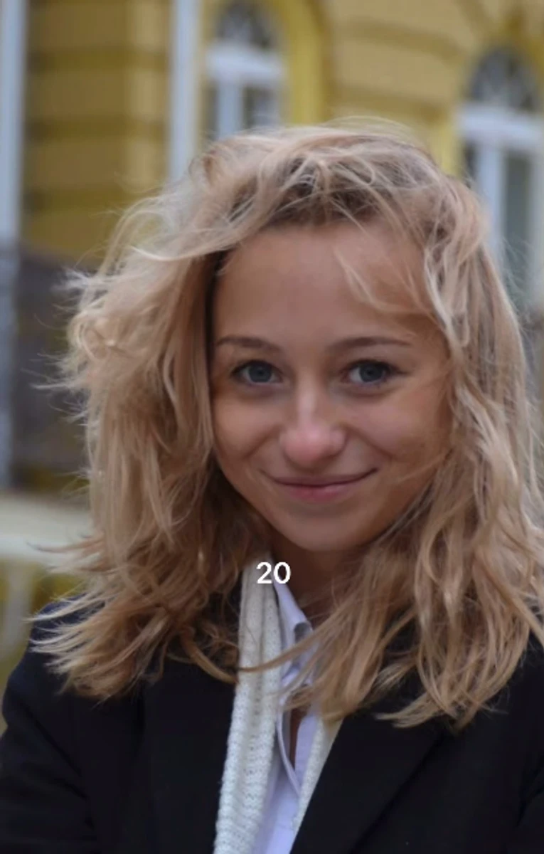 Катерина Репяхова до уколів краси