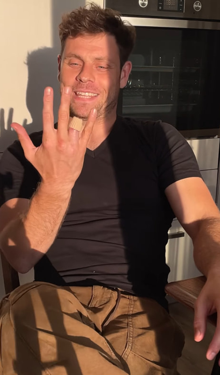 Артур Логай показав відірваний палець