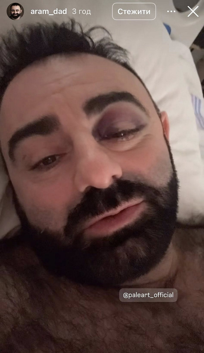 Арам Арзуманян упав у оркестрову яму