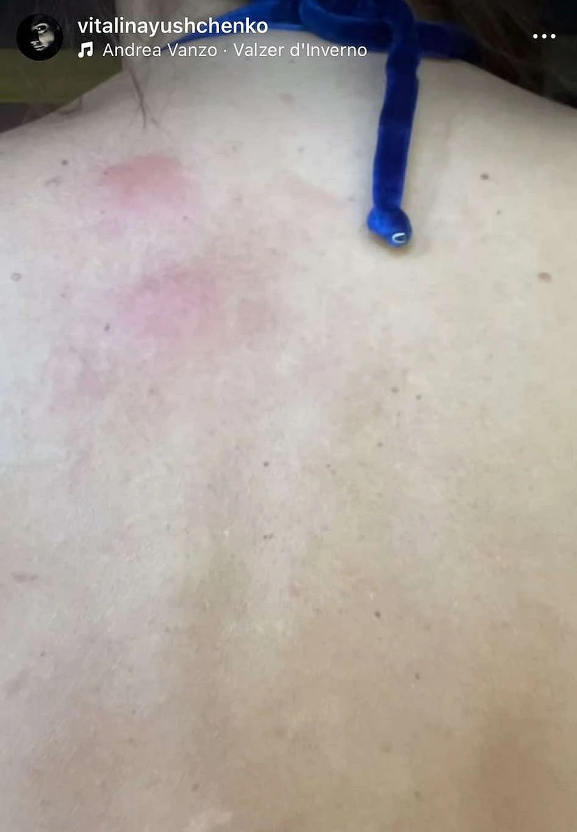 Віталіна Ющенко шершень